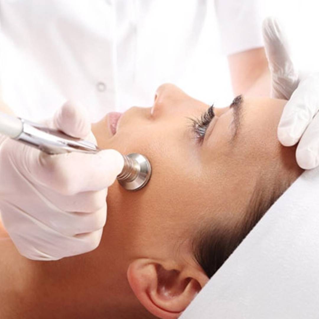 Peeling físico