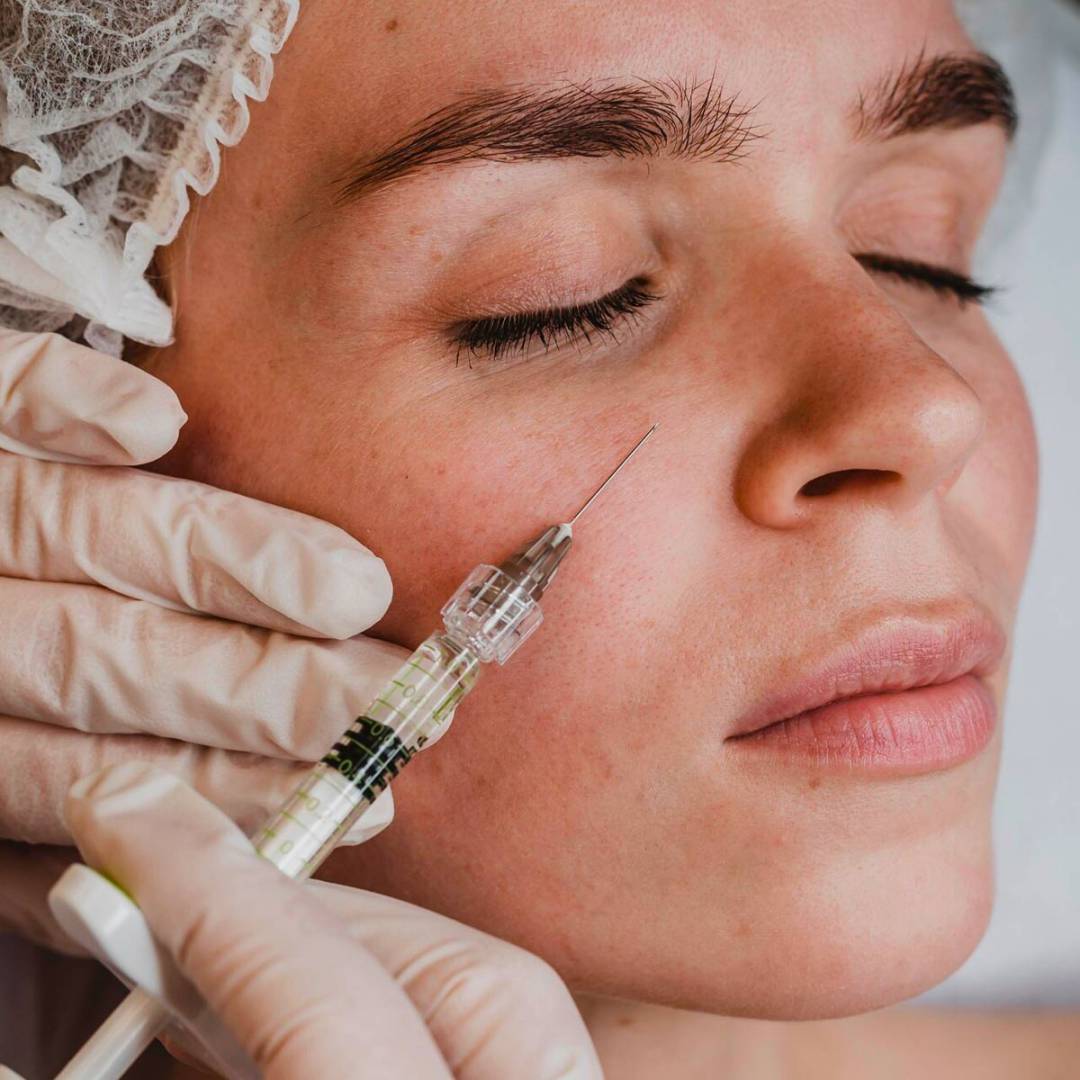 Mesoterapia Facial